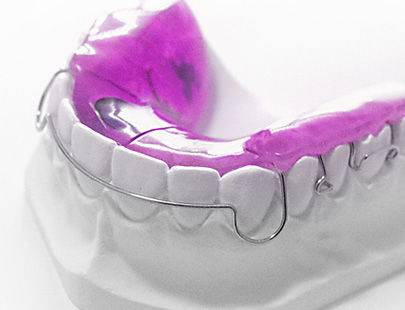 Gipsmodell mit abnehmbarem Retainer: dünner Draht umschließt die Zähne, rosa Kunststoff sitzt im Gaumenbereich; helle, minimalistische Studioumgebung.