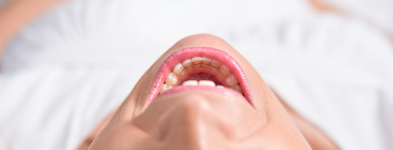 Unterkieferfrontzähne zeigen einen festsitzenden Drahtretainer an der Innenseite; der Mund ist weit geöffnet, Lippen nach hinten gezogen, die Person liegt zurück auf hellem, unscharfem Hintergrund.